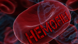 Hemofili Hastalarına Türkiye’de İlk Kez Uygulanacak